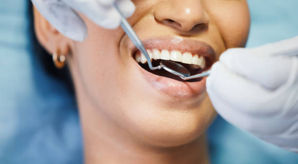 Best Emergency Wisdom Teeth Removal in Kenmore, WA