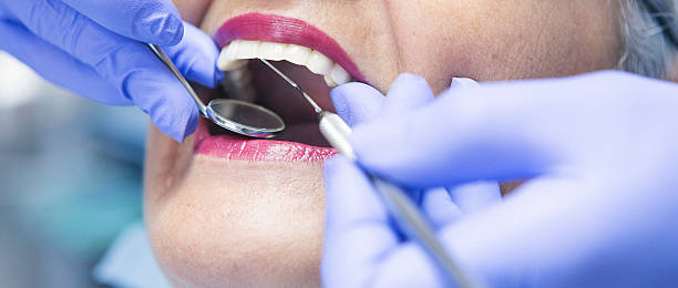 Best Weekend Emergency Dentist in Kenmore, WA